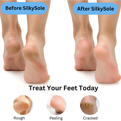 SilkySole - Electric Foot Callus Remover